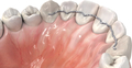 prime4me® RETAIN3R maxillaire