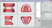 Module Retainer 3D OnyxCeph³™